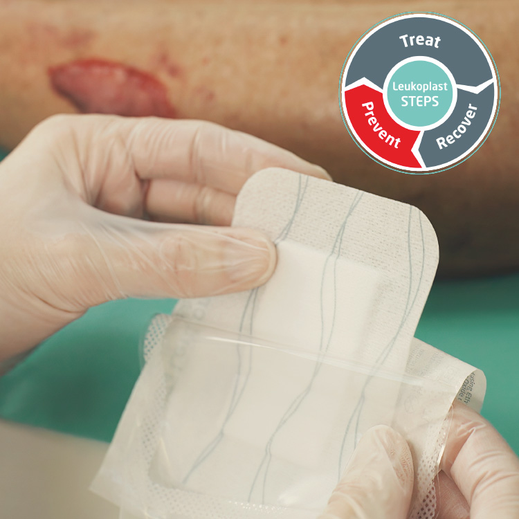 Image showing a wound care situation with the focus on prevention Image showing a wound care situation with the focus on prevention